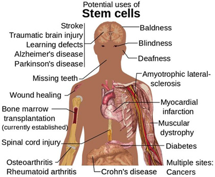 How stem cell therapy works